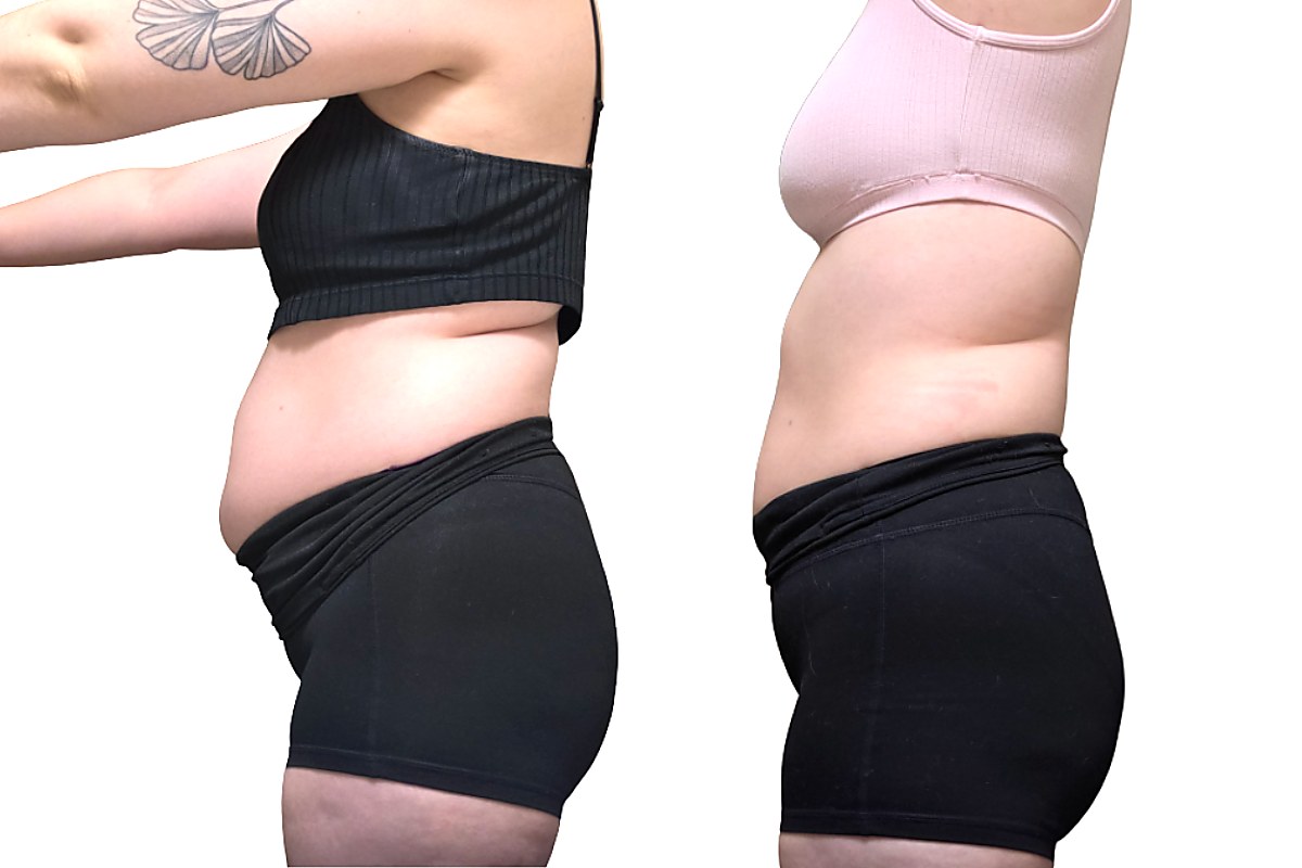 Client transformation