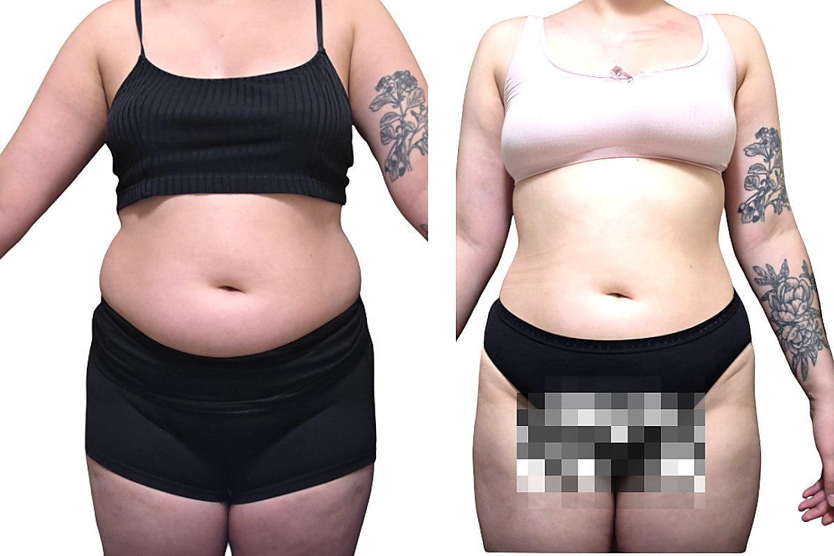 Client transformation